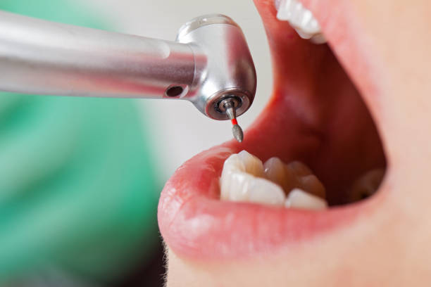 Best Emergency Dental Care for Sports Injuries in Ashdown, AR